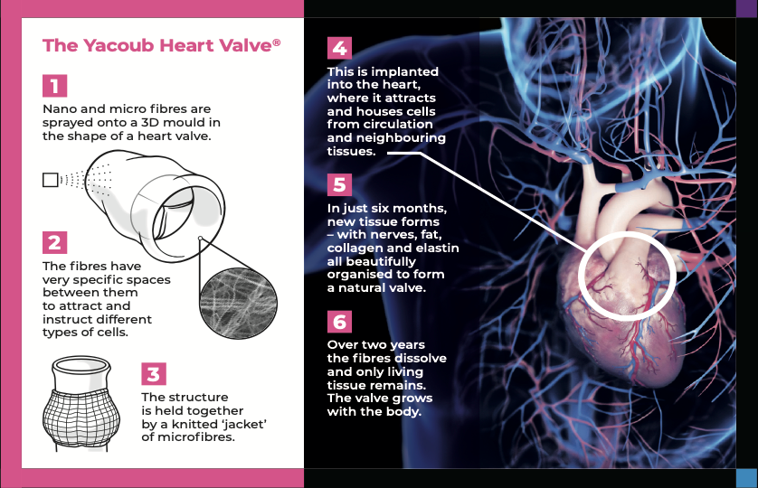Diagram showing how the Yacoub heart valve forms into a living valve over six to 24 months.